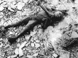 Hiroshima bomb victim